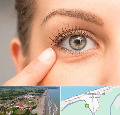 جراح پف چشم در محمودآباد