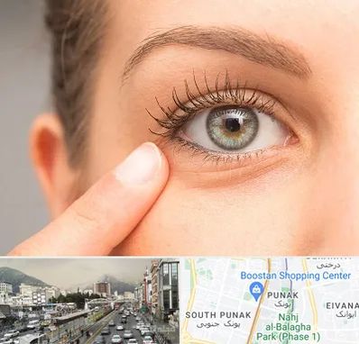جراح پف چشم در پونک 