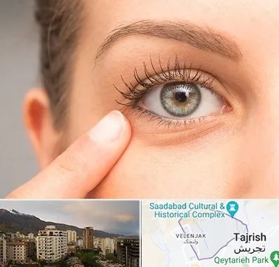 جراح پف چشم در زعفرانیه 