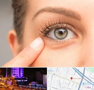 جراح پف چشم در آبرسان تبریز