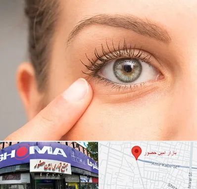 جراح پف چشم در امین حضور