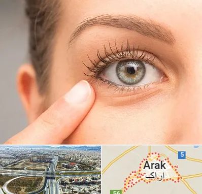 جراح پف چشم در اراک