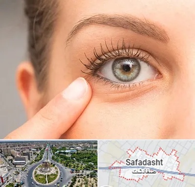جراح پف چشم در صفادشت