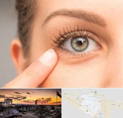 جراح پف چشم در قوچان