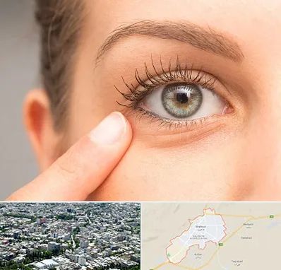 جراح پف چشم در شاهرود