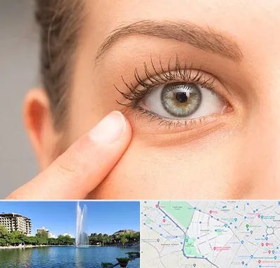 جراح پف چشم در کوهسنگی مشهد