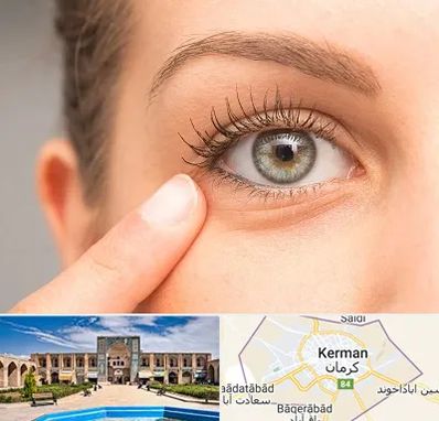 جراح پف چشم در کرمان