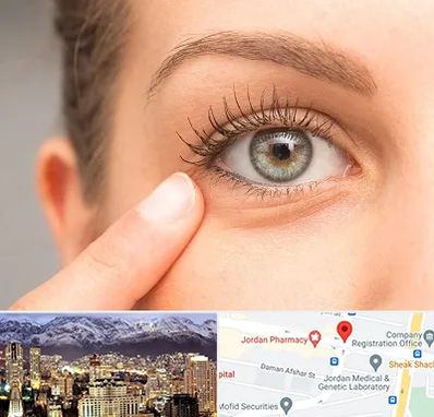 جراح پف چشم در جردن 