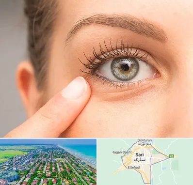 جراح پف چشم در ساری