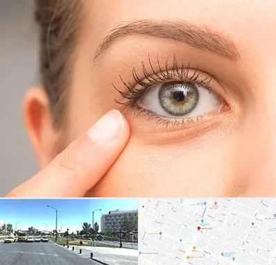 جراح پف چشم در بلوار کلاهدوز مشهد 