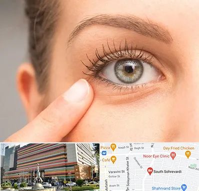 جراح پف چشم در سهروردی 