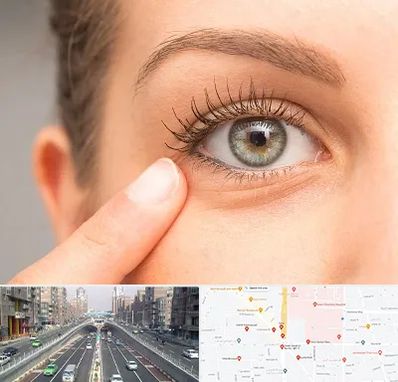 جراح پف چشم در توحید 