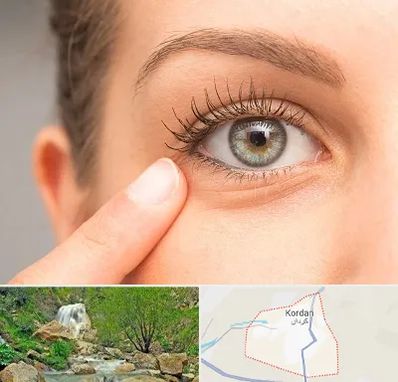 جراح پف چشم در کردان