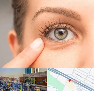 جراح پف چشم در لاله پارک تبریز