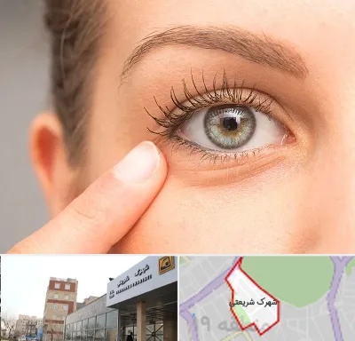 جراح پف چشم در شهرک شریعتی