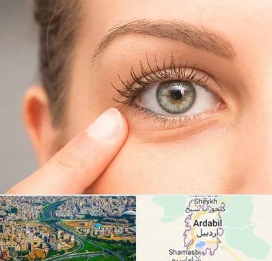 جراح پف چشم در اردبیل