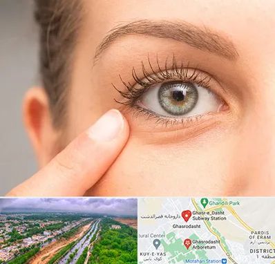 جراح پف چشم در قصرالدشت شیراز