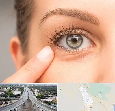 جراح پف چشم در اندیمشک