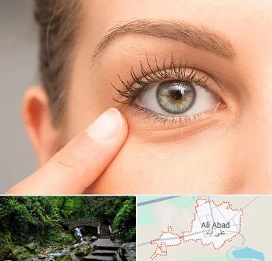 جراح پف چشم در علی‌ آباد کتول