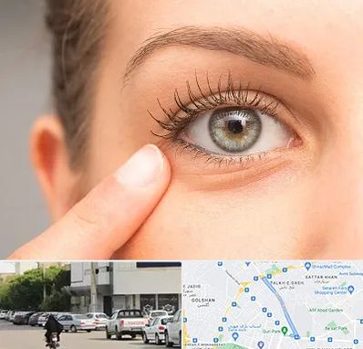 جراح پف چشم در قدوسی شرقی شیراز