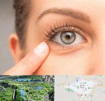 جراح پف چشم در بجنورد