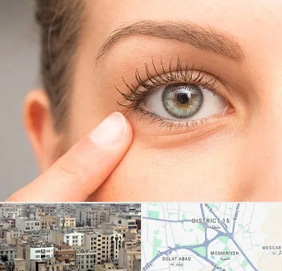 جراح پف چشم در جنوب شرق تهران