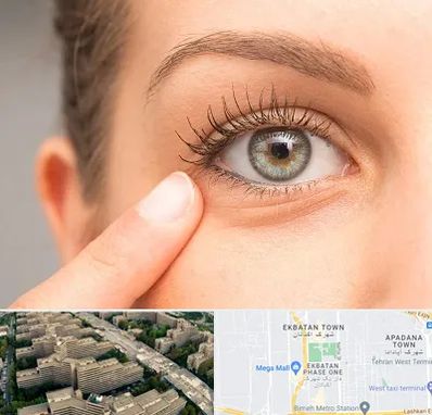 جراح پف چشم در اکباتان 