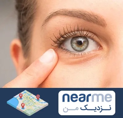 جراح پف چشم در نزدیک من