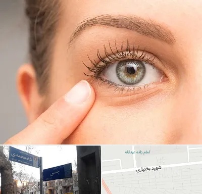 جراح پف چشم در سی متری جی