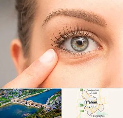 جراح پف چشم در اصفهان