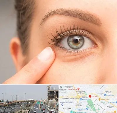 جراح پف چشم در بلوار توس مشهد 