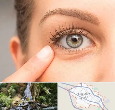 جراح پف چشم در الیگودرز