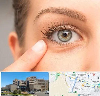 جراح پف چشم در صیاد شیرازی مشهد