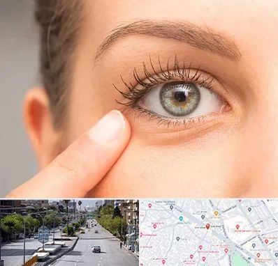 جراح پف چشم در خیابان زند شیراز