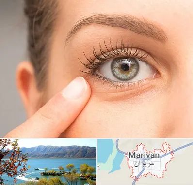 جراح پف چشم در مریوان