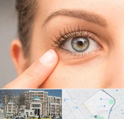 جراح پف چشم در طلاب مشهد