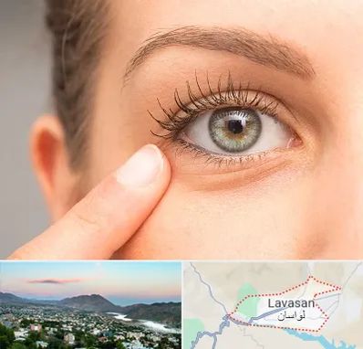 جراح پف چشم در لواسان