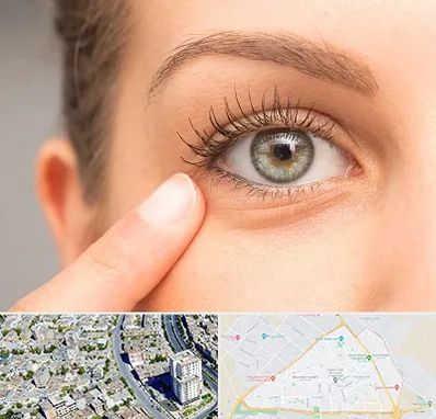 جراح پف چشم در قاسم آباد مشهد 