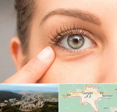 جراح پف چشم در گرگان