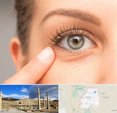 جراح پف چشم در مرودشت