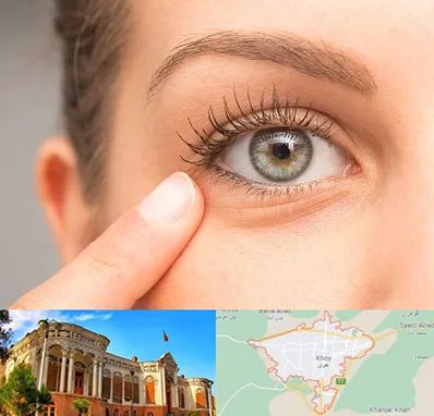 جراح پف چشم در خوی