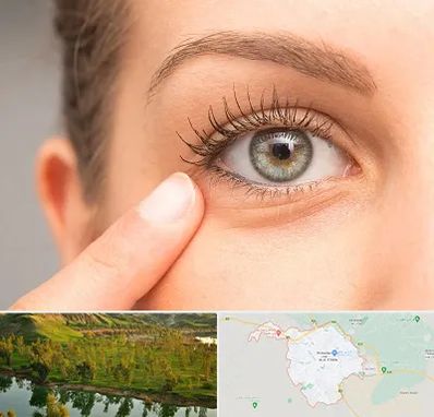 جراح پف چشم در بهبهان