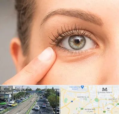 جراح پف چشم در جنوب تهران 