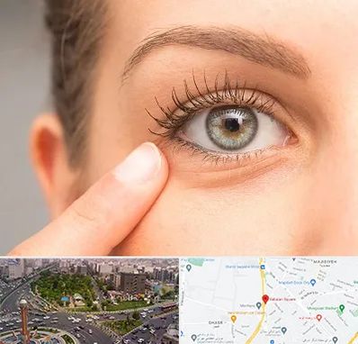 جراح پف چشم در سبلان 