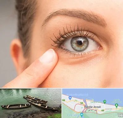 جراح پف چشم در بندر انزلی