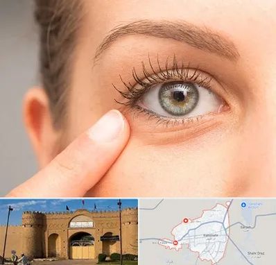 جراح پف چشم در ایرانشهر