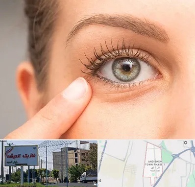 جراح پف چشم در فاز یک اندیشه
