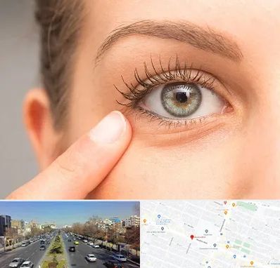 جراح پف چشم در بلوار معلم مشهد 