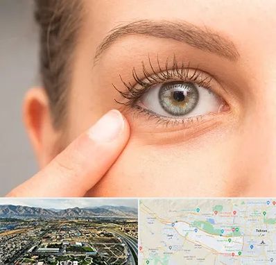 جراح پف چشم در منطقه 21 تهران 