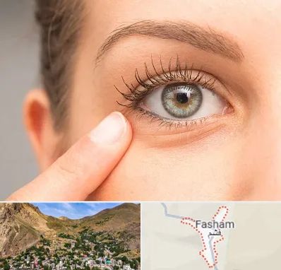 جراح پف چشم در فشم